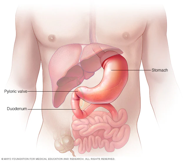 Gastritis treatment in ariyakudi