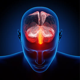 Migraine treatment in ariyakudi